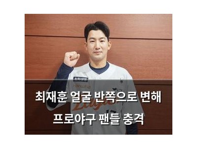최재훈 얼굴 반쪽으로 변해 프로야구 팬들 충격